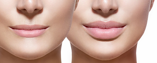 Lip Service